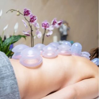Cupping Therapy Treatment